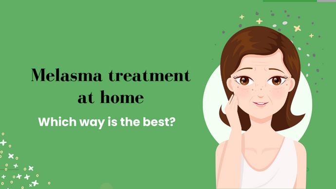 Melasma treatment at home: which way is the best?